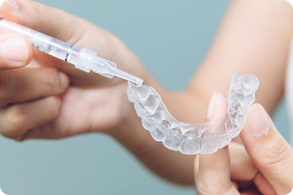 Amélioration de la teinte des dents à Rambouillet