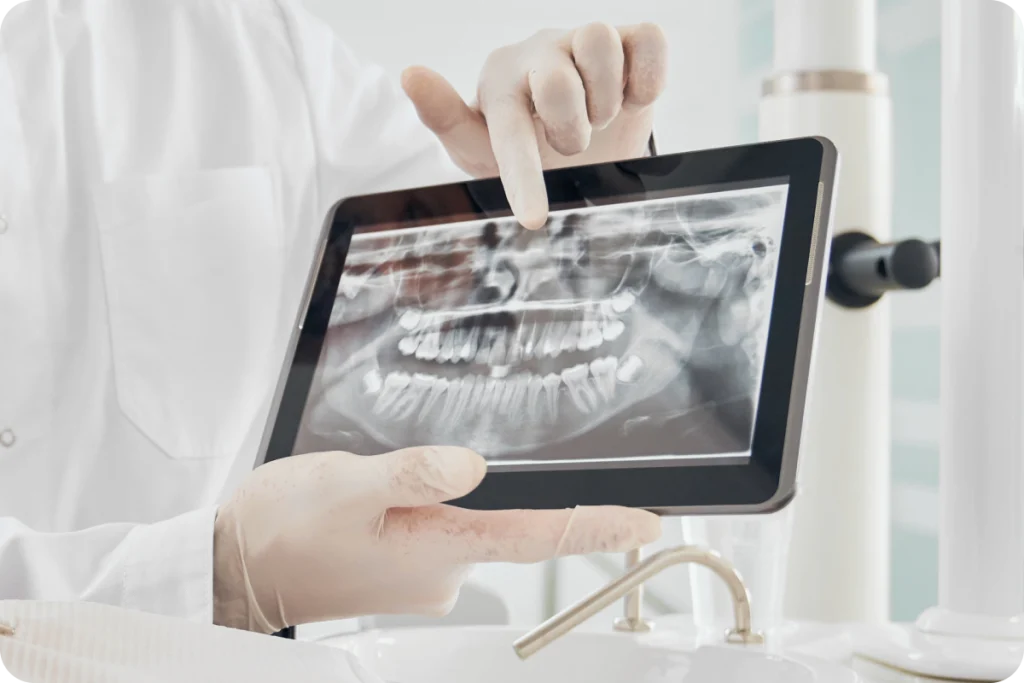 Radiographie des gencives déchaussées à Rambouillet